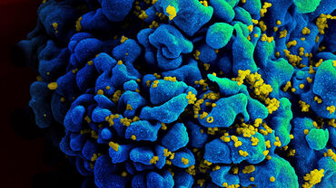 HIV-infected H9 T Cell. Credit: NIAID