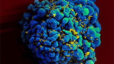 HIV-infected H9 T Cell. Credit: NIAID
