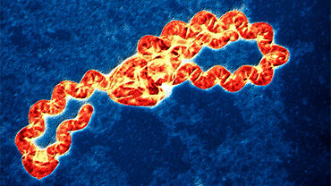 Leptospira bacterium, TEM. © Science Photo Library