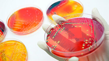 Bacteria in Petri dish. © Istock