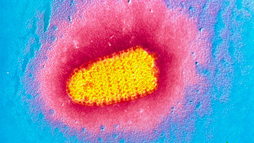 TEM of rabies virus. © Science Photo Library