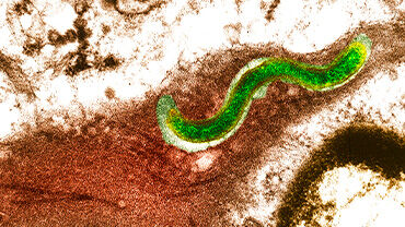Syphilis bacterium (Treponema pallidum). © Science Photo Library