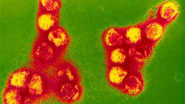 Coloured TEM of tick-borne encephalitis virus. © Science Photo Library