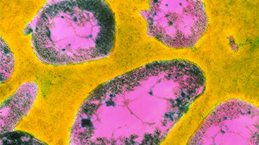 Francisella tularensis bacteria. © Science Photo Library