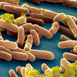 Salmonellosis_H Thumbnail