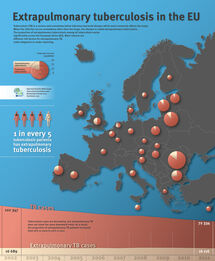 Extrapumonary tuberculosis in the EU Thumbnail