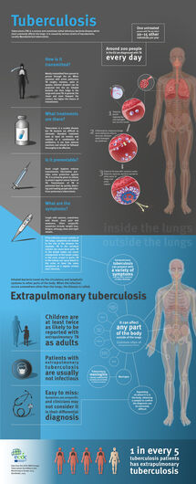 What is extrapulmonary tuberculosis? Thumbnail