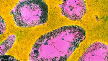 Tularemia_H Thumbnail